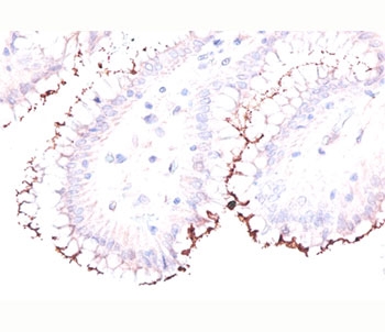 Formalin/paraffin human stomach stained with Helicobacter pylori antibody.