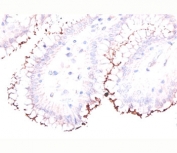 IHC testing of formalin/paraffin human stomach stained with Helicobacter pylori antibody.