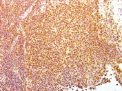 IHC testing of acetone-fixed frozen human tonsil tissue with Nuclear Antigen antibody (clone 235-1).