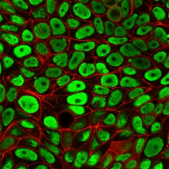 ICC staining of paraformaldehyde-fixed human HeLa cells with Nuclear Antigen antibody (red, clone 235-1) and counterstained with DyLight 488 conjugated Phalloidin (green).