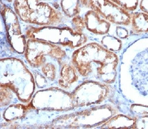 IHC testing of renal cell carcinoma and Mitochondrial Marker antibody (113-1).~