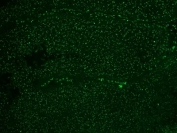 Immunofluorescent staining of FFPE colon carcinoma with Alexa Fluor 488 conjugated Nucleoli Marker antibody. HIER: boil tissue sections in pH6, 10mM citrate buffer, for 10-20 min and allow to cool before testing.