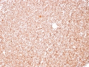 IHC staining of FFPE human tonsil with Nucleoli Marker antibody. HIER: boil tissue sections in pH6, 10mM citrate buffer, for 10-20 min and allow to cool before testing.