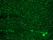 Immunofluorescent staining of FFPE colon carcinoma with Human Nucleolar Antigen antibody. HIER: boil tissue sections in pH 9 10mM Tris with 1mM EDTA for 10-20 min and allow to cool before testing.