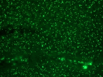 Immunofluorescent staining of FFPE colon carcinoma with Human Nucleolar Antigen antibod