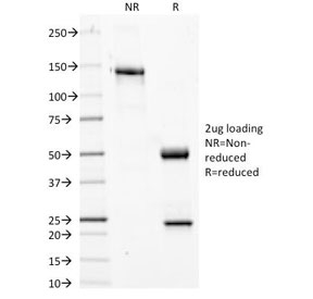 SDS-PAGE Analysis of Purified, BSA-Free Phosphotyrosine Antibody (clone PY20). Confirmation of Integrity and Purity of th