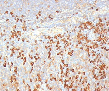 FFPE human tonsil stained with plasma cell marker antibody (LIV3G11).