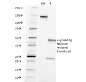 SDS-PAGE analysis of purified, BSA-free TAG-72 antibody (clone B72.3) as confirmation of integrity and purity.