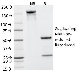 SDS-PAGE Analysis of Purified, BSA-Free PSA Antibody (KLK3/801). Confirmation of Integrity and Purity of the Antibody.