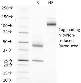 SDS-PAGE Analysis of Purified, BSA-Free EMA Antibody (clone MUC1/845). Confirmation of Integrity and Purity of the Antibody.