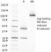 SDS-PAGE Analysis of Purified, BSA-Free EMA Antibody (clone MUC1/845). Confirmation of Integrity and Purity of the Antibody.