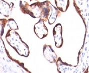 Immunohistochemical testing of human placenta with HCG-beta antibody (HCGb/459).