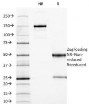 SDS-PAGE Analysis of Purified, BSA-Free CEA Antibody (clone C66/1009). Confirmation of Integrity and Purity of the Antibody.