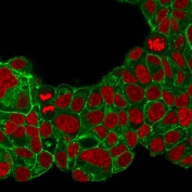 Immunofluorescent staining of PFA-fixed human MCF7 cells with HER-2 antibody (clone ERB2/776, green) and Reddot nuclear stain (red).