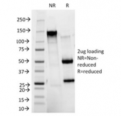 SDS-PAGE analysis of purified, BSA-free HER2 antibody as confirmation of integrity and purity.