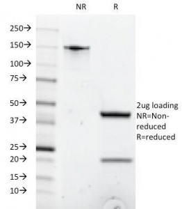 SDS-PAGE Analysis of Purified, BSA-Free Anti-CD8 Antibody (clone C8/1035). Confirmation of Integrity and P