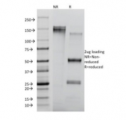 SDS-PAGE analysis of purified, BSA-free CD8 antibody (clone RIV11) as confirmation of integrity and purity.
