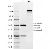 SDS-PAGE analysis of purified, BSA-free CD19 antibody (clone C19/366) as confirmation of integrity and purity.