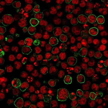 Immunofluorescent staining of human MOLT4 cells with anti-CD20 antibody (green, clone SPM618) and Reddot nuclear stain (red).~