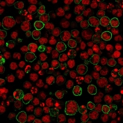 Immunofluorescent staining of human MOLT4 cells with anti-CD20 antibody (green, clone SPM618) and Reddot nuclear stain (red).