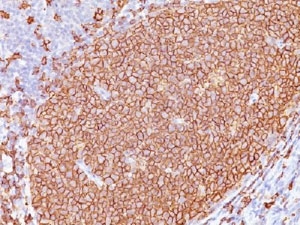 IHC testing of CD20 antibody and FFPE human tonsil tissue. HIER: boil tissue sections in pH 9 10mM Tris with 1mM EDTA for 20 min and allow to cool before testing.~