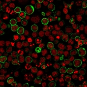 Immunofluorescent staining of human Raji cells with CD20 antibody cocktail (clones L26 + IGEL/733, green) and Reddot nuclear stain (red).