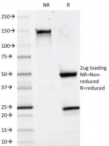 SDS-PAGE Analysis of Purified, BSA-Free CD20 Antibody (clone 93-1B3). Confirmation of Integrity and Purity of the Antibody.