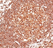 IHC staining of FFPE human tonsil tissue with CD45 antibody (clone 136-4B5).