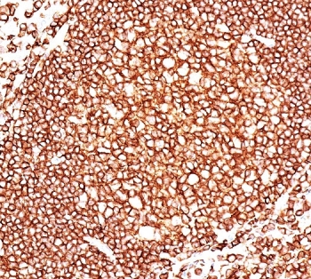 IHC staining of FFPE human tonsil tissue with CD45 antibody (clone 136-4B5).