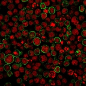 Immunofluorescent staining of human MOLT-4 cells with CD20 antibody (green, clone SPM494) and Reddot nuclear stain (red).