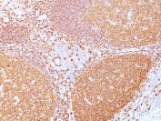 IHC staining of FFPE human tonsil tissue with CD20 antibody (clone IGEL/773).