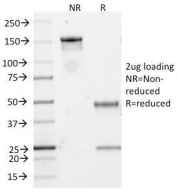 SDS-PAGE analysis of purified, BSA-free CD20 antibody (clone IGEL/773) as confirmation of integrity and purity.