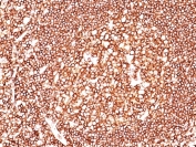 IHC staining of FFPE human tonsil tissue with CD45 antibody (clone 135-4C5).
