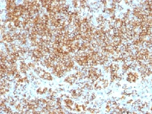 IHC test of FFPE human tonsil probed with CD45 antibody cocktail~