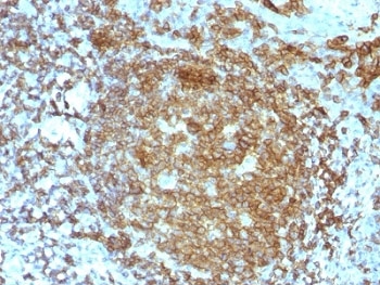 IHC test of FFPE human tonsil probed with CD45RA antibody. HIER: boil tissue sections in 10mM citrate buffer, pH 6, for 10-20 min followed by cooling at RT for 20 minutes.~
