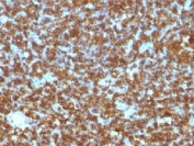 IHC staining of FFPE human tonsil tissue with CD45RA antibody (clone PTPRC/1131). HIER: boil tissue sections in pH 9 10mM Tris with 1mM EDTA for 20 min and allow to cool before testing.