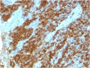 IHC staining of FFPE human tonsil tissue with CD45RA antibody (clone 111-1C5). HIER: boil tissue sections in pH 9 10mM Tris with 1mM EDTA for 20 min and allow to cool before testing.