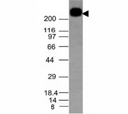 Western blot testing of CD45RB antibody and Daudi lysate. Expected molecular weight: ~147/180-220 kDa (unmodified/glycosylated).~