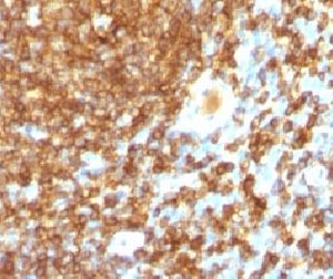 IHC test of FFPE human tonsil probed with CD45RB antibody (PTPRC/1132).~