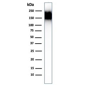 Western blot testing of human spleen lysate with CD45RA antibody (clone SPM504). Expected molecular weight: 147-220 kDa depending on glycosylation level.~