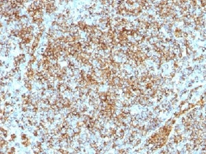 IHC testing of CD45RB antibody and FFPE human lymphoma~