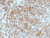 IHC testing of CD45RB antibody and FFPE human lymphoma