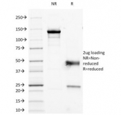 SDS-PAGE Analysis of Purified, BSA-Free CD45RO Antibody (clone 190-2F2.5). Confirmation of Integrity and Purity of the Antibody.