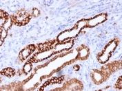IHC testing of FFPE human kidney with Cadherin 16 antibody (clone CDH16/1071). Required HIER: boil tissue sections in 10mM Tris with 1mM EDTA, pH 9, for 10-20 min followed by cooling at RT for 20 min.