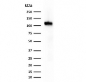 Western blot testing of human kidney lysate with Cadherin 16 antibody (clone CDH16/1071). Expected molecular weight: 90~130 kDa.