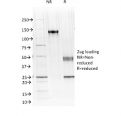 SDS-PAGE analysis of purified, BSA-free Cadherin 16 antibody (clone CDH16/1071) as confirmation of integrity and purity.