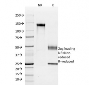 SDS-PAGE analysis of purified, BSA-free anti-Cadherin 16 antibody (clone SPM594) as confirmation of integrity and purity.
