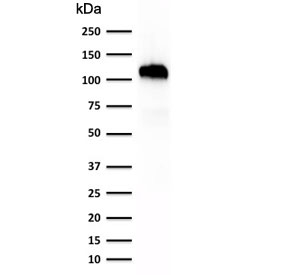 Western blot testing of human kidney lysate with anti-Cadherin 16 antibody (clone SPM594). Expected molecular weigh