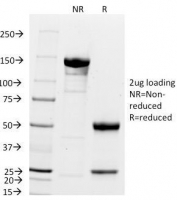 SDS-PAGE Analysis of Purified, BSA-Free p21 Antibody (clone DCS-60.2). Confirmation of Integrity and Purity of the Antibody.