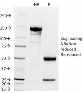 SDS-PAGE Analysis of Purified, BSA-Free p21 Antibody (clone DCS-60.2). Confirmation of Integrity and Purity of the Antib